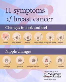 Breast Cancer Warning Signs : r/coolguides